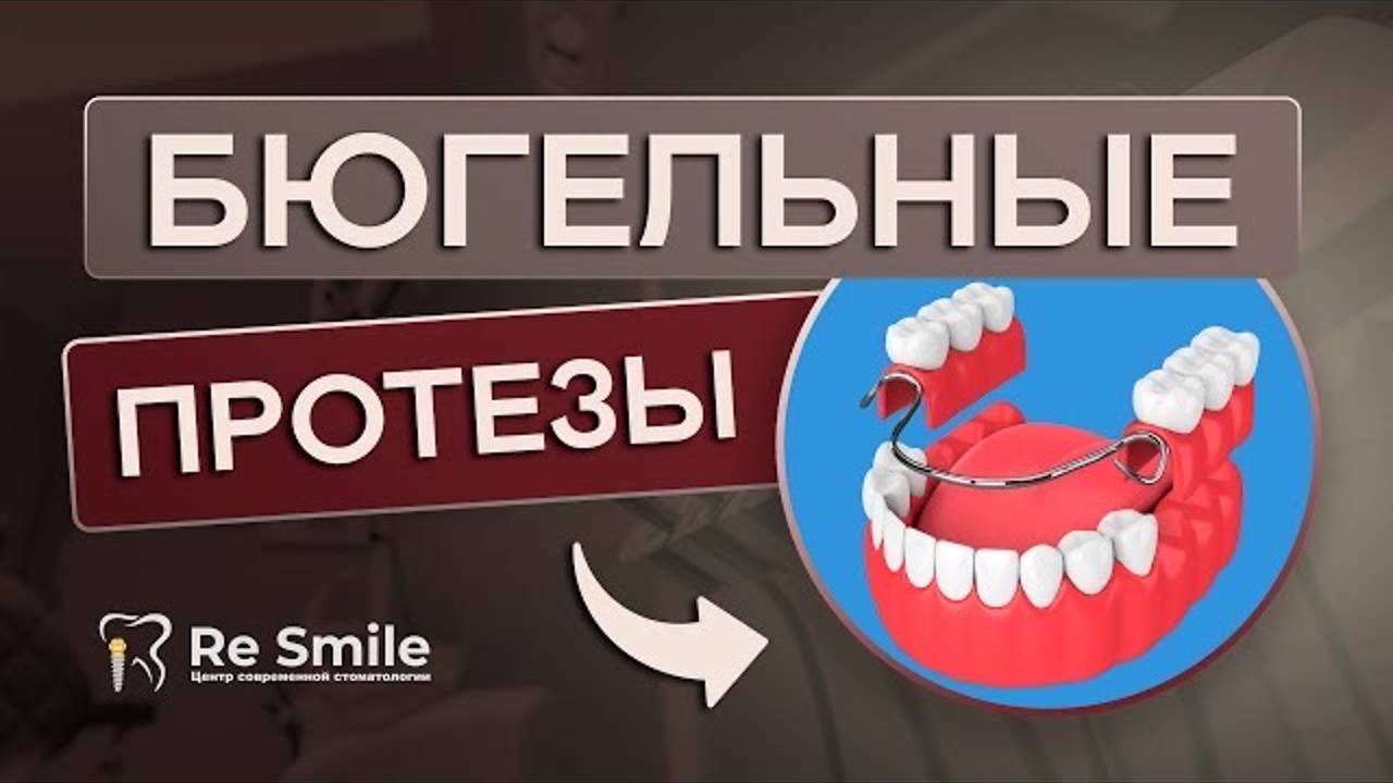 Бюгельные протезы. Современный метод восстановления отсутствующих зубов.