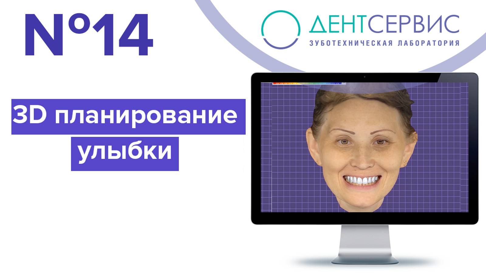 3D планирование улыбки