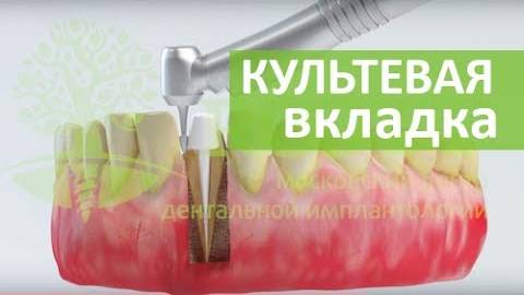 Микропротезирование и культевая вкладка