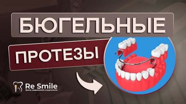 Бюгельные протезы. Современный метод восстановления отсутствующих зубов