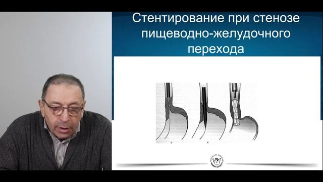 Архив - Осложненные формы онкологических заболеваний. Фридман М.Х