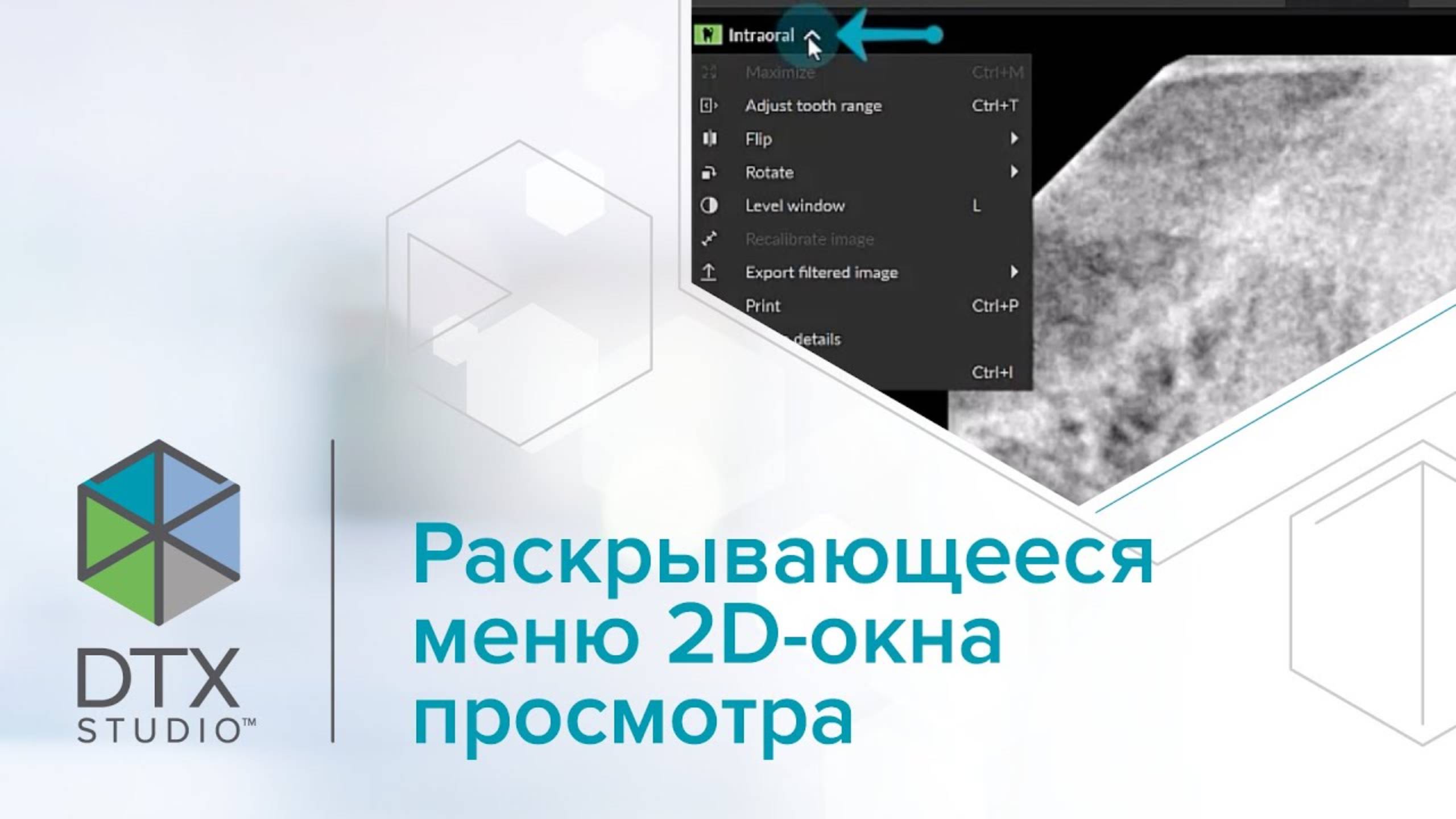 Раскрывающееся меню 2D-окна просмотра | DTX Studio Clinic