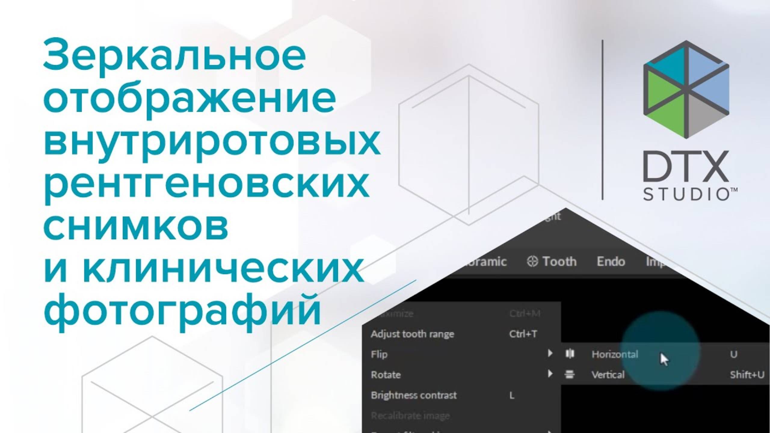 Зеркальное отображение внутриротовых рентгеновских снимков и клинических фотографий | DTX