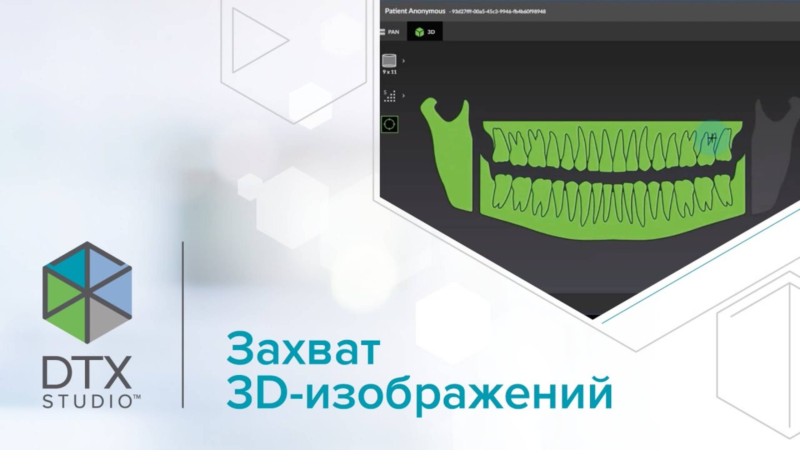 Захват 3D изображений | DTX Studio Clinic