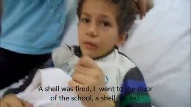 (2014) Children injured by terrorist shelling of Manar school, old Damascus