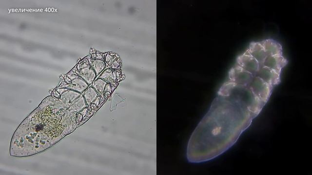 Мелкий паразит живет в коже каждого человека - Угревая Железница (Demodex)