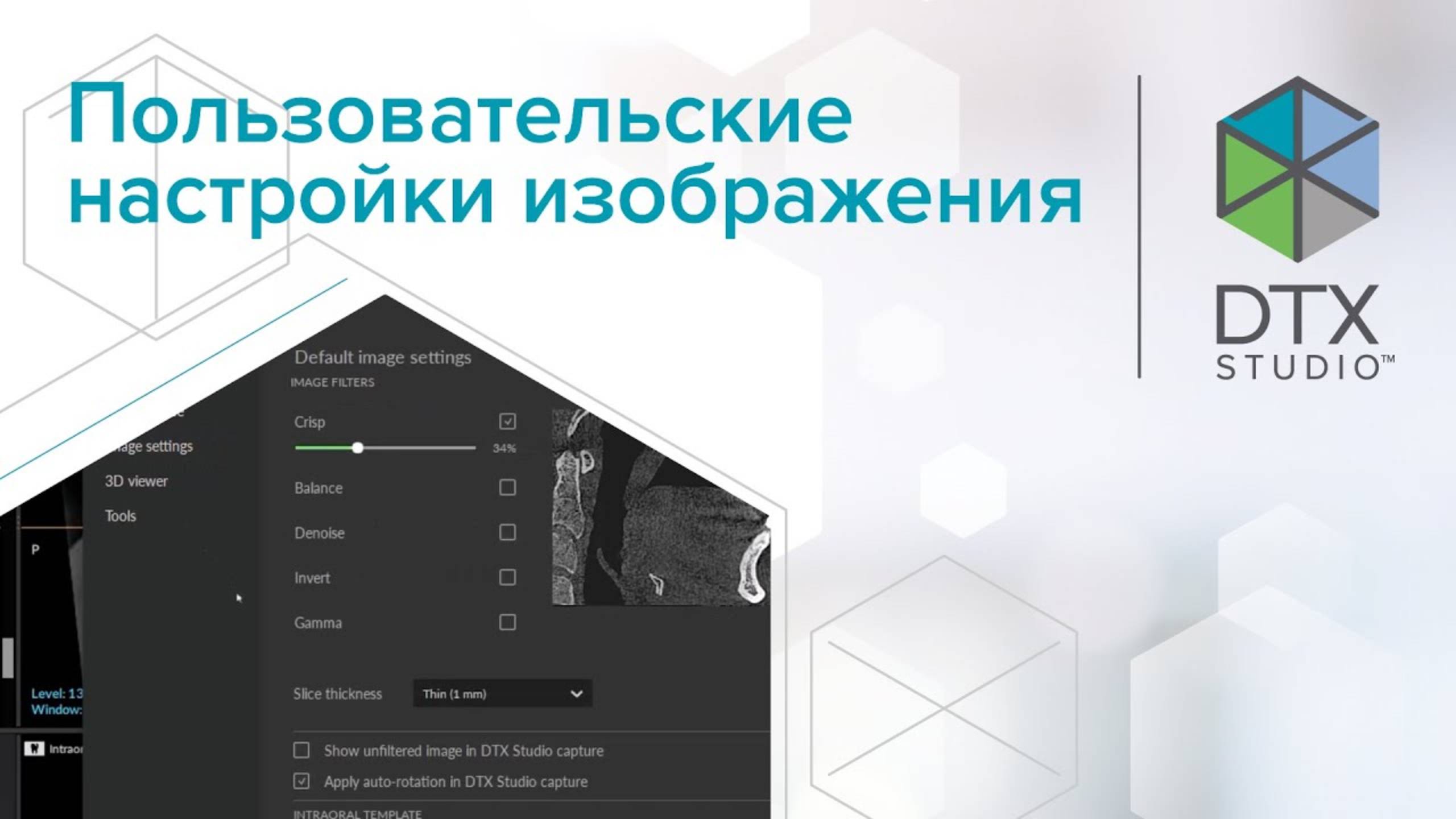 Пользовательские настройки изображения | DTX Studio Clinic