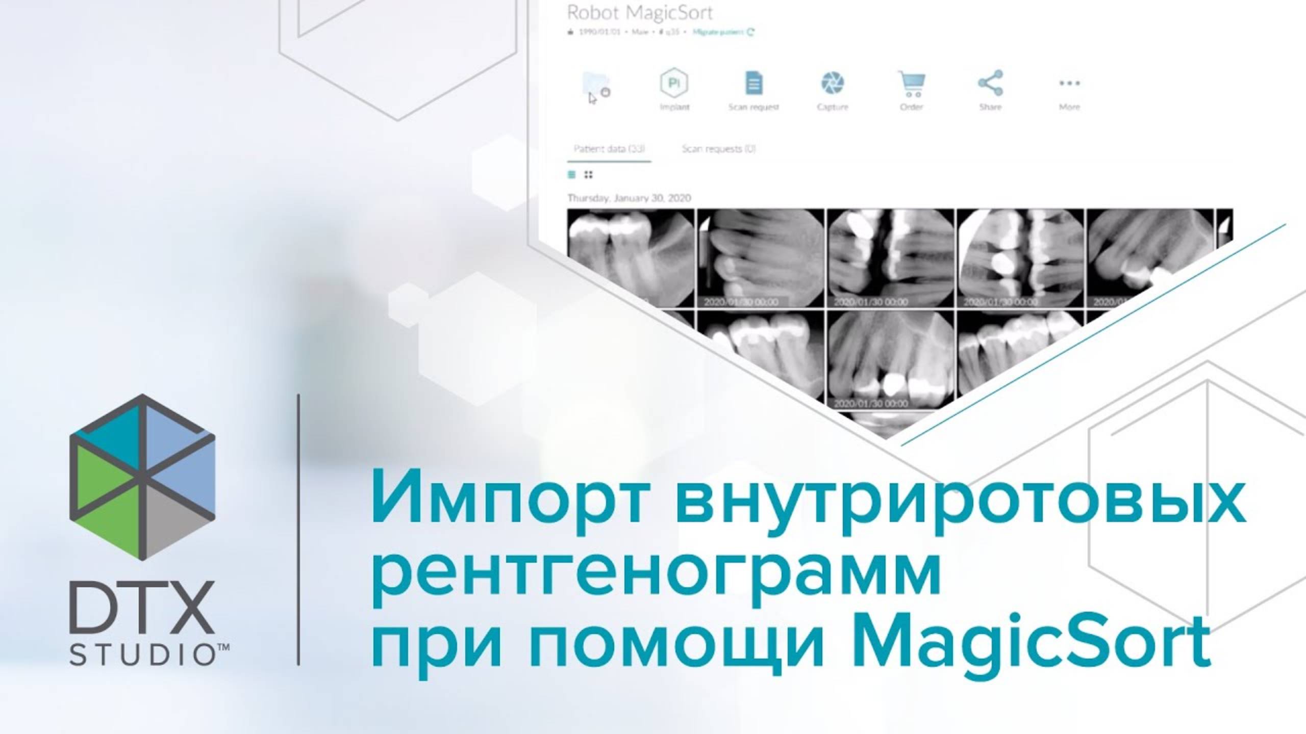 Импорт внутриротовых рентгенограмм при помощи MagicSort | DTX Studio Clinic