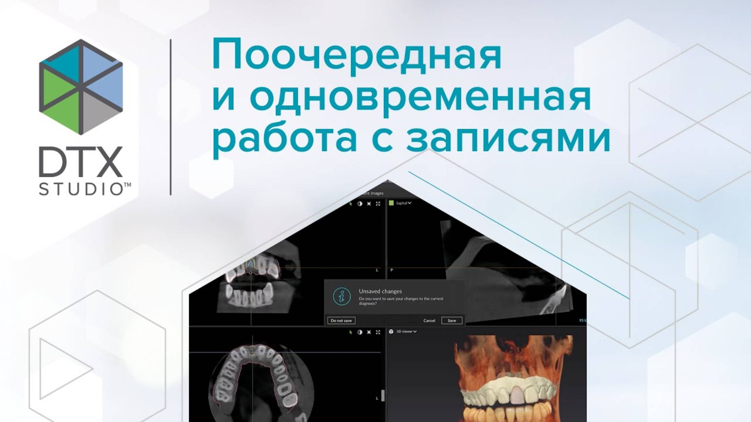 Поочередная и одновременная работа с записями | DTX Studio Clinic