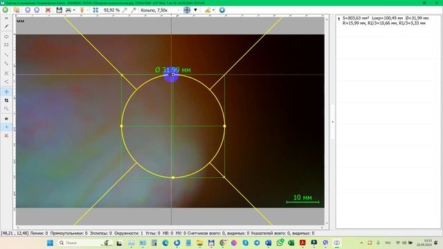 2024-09-26_193756-Окно оценка и измерение - выбор типа кольпоскопической сетки, толщины, цвета, разм