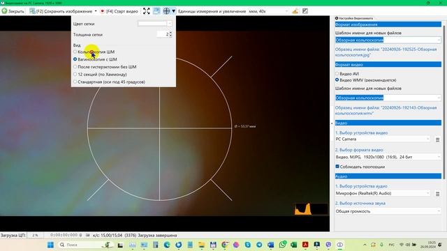 2024-09-26_192759-Окно Видеозахват - реализовано несколько Сеток Кольпоскопии, ПО ДИАНЕЛ®-МИКРО