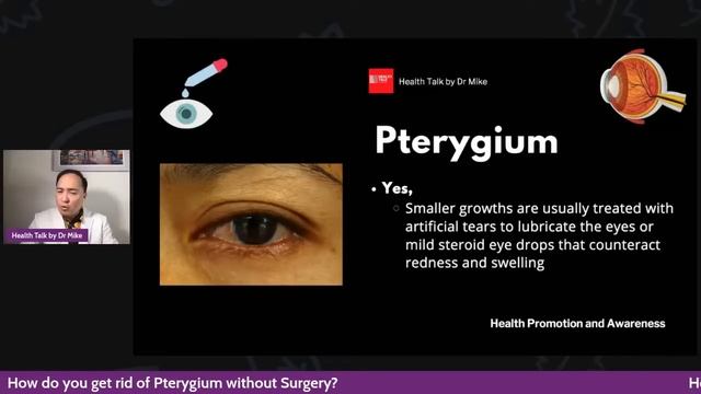 How do you get rid of Pterygium (Pugita) without Surgery?