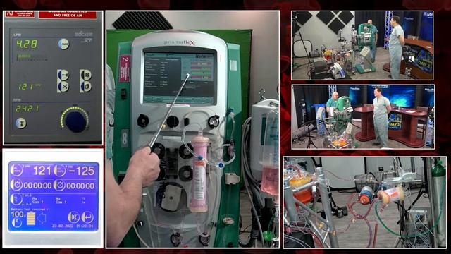 PerfWeb 76 - Day 2 - How to incorporate CRRT into your ECMO circuit