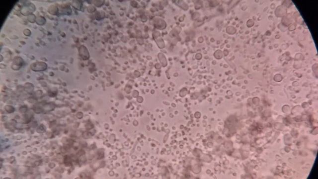 peynir küfü 15*40 mikroskop görüntüsü  cheese mold 15 * 40 microscope view