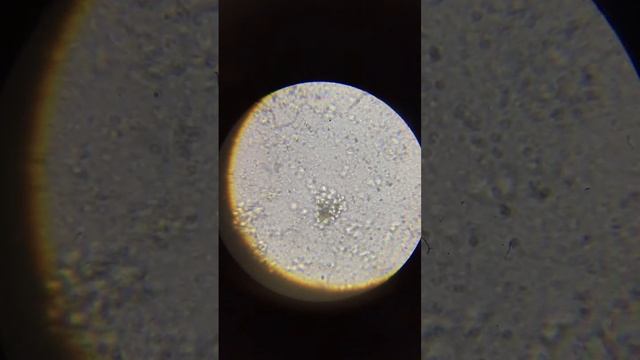 mold under microscope 1 (HD)