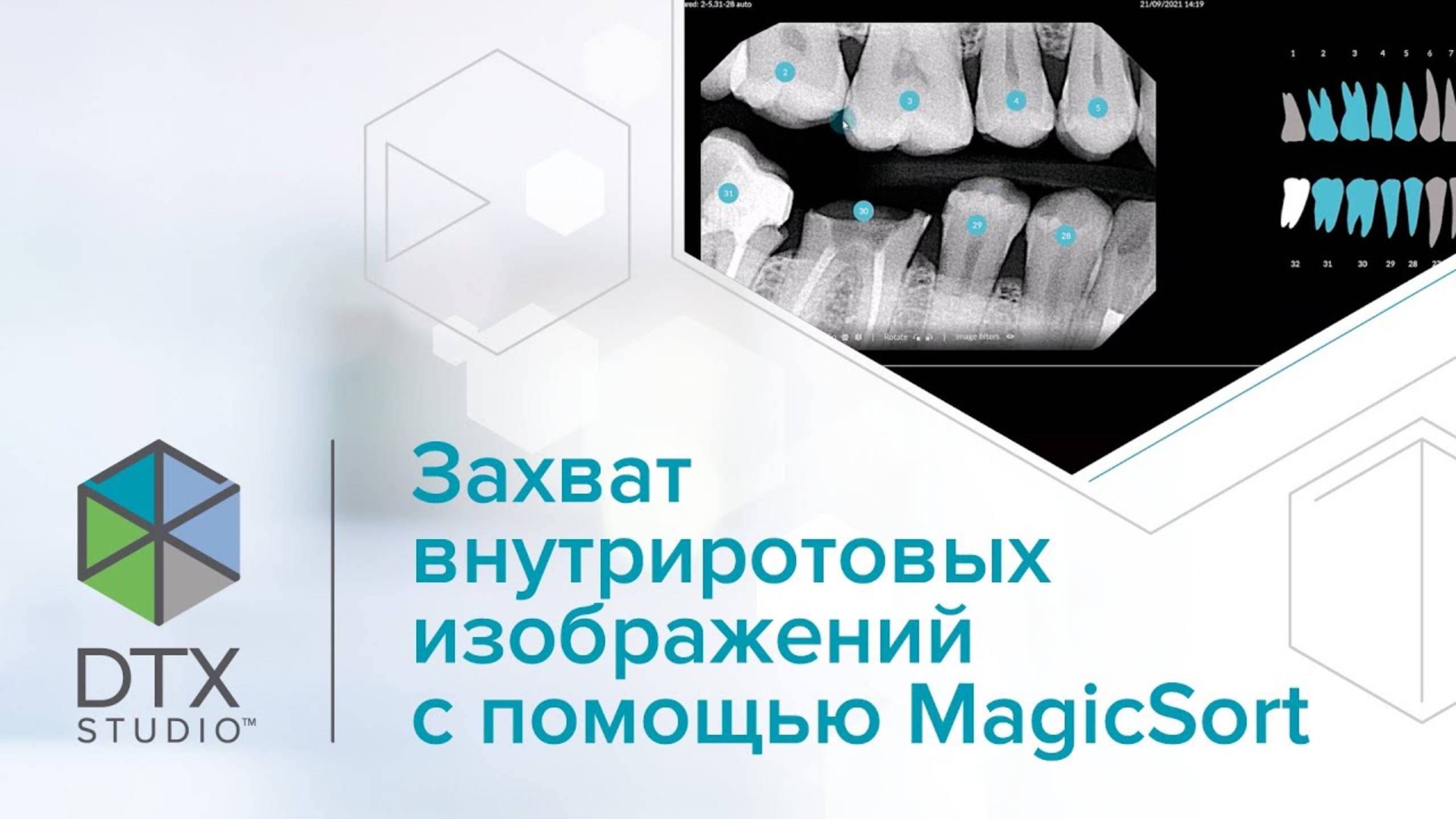 Захват внутриротовых изображений с помощью MagicSort | DTX Studio Clinic