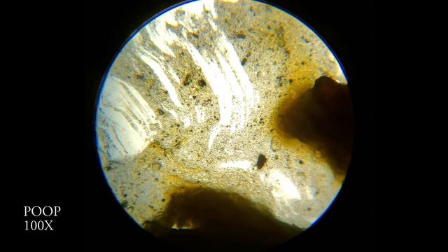 POOP UNDER MICROSCOPE - 100X 250X 1000X 4K