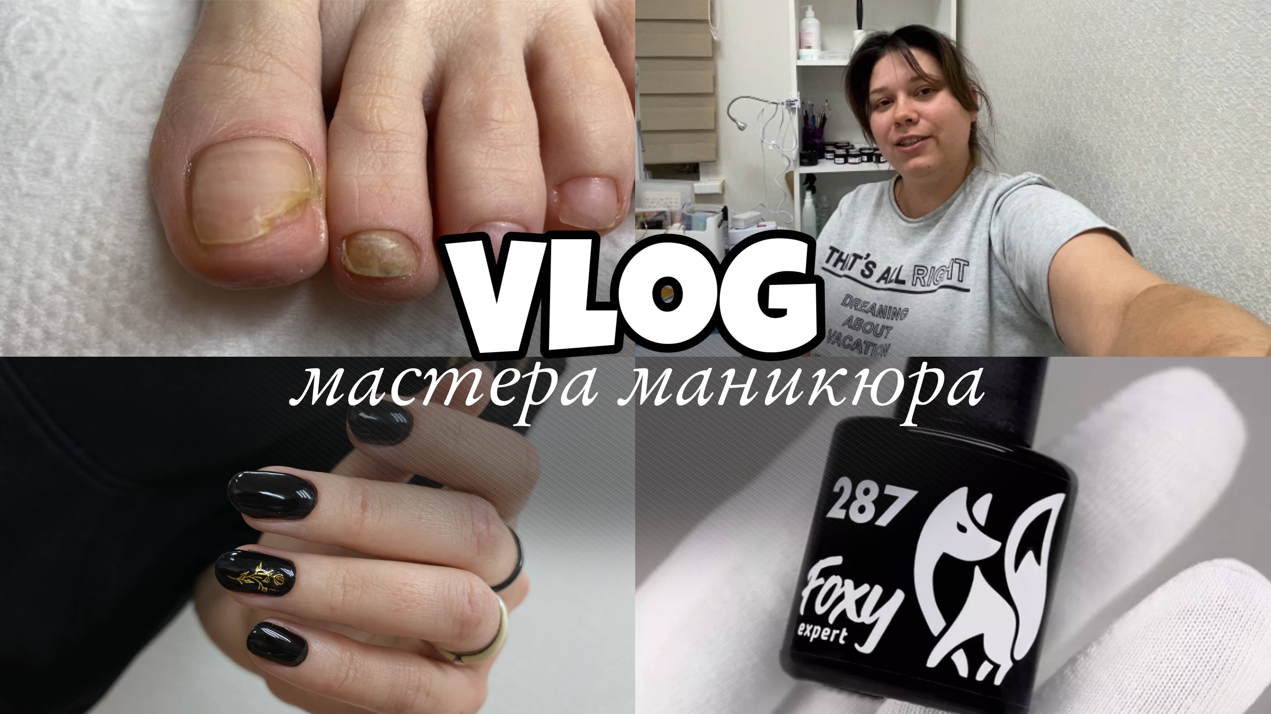 Nail Vlog 70 Будни мастера /У клиентки онихолизис