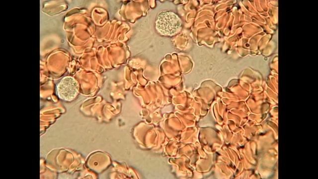 Кровь человека под микроскопом.