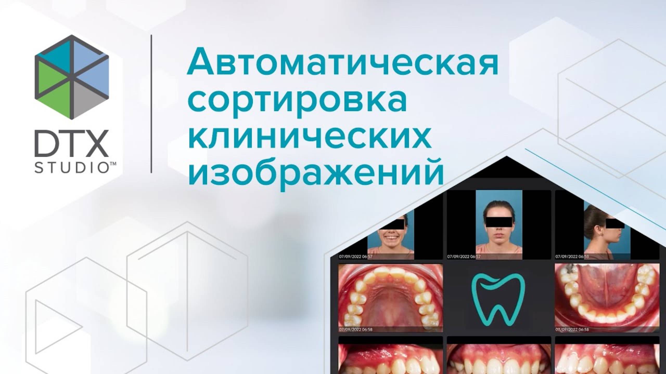 Автоматическая сортировка клинических изображений | DTX Studio Clinic