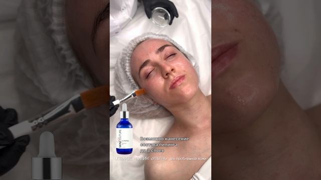 Пилинг UltraPeel SKINCOUTURE
