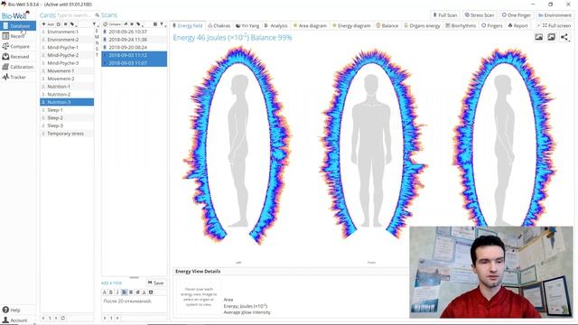 Bio-Well GDV Camera as a lifestyle analysis tool