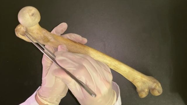 Бедренная кость  — femur, os femoris.