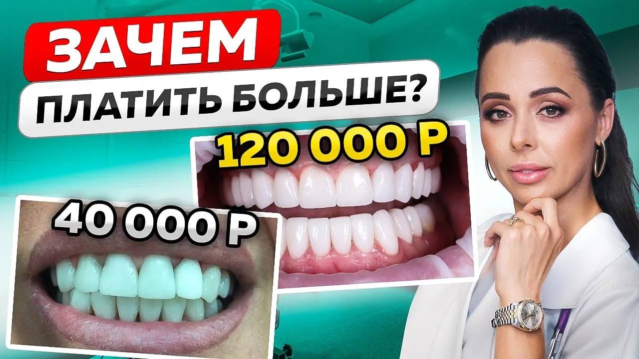 Виниры vs Люминиры: Сколько стоят виниры? Композитные, Керамические и Рефракторные виниры