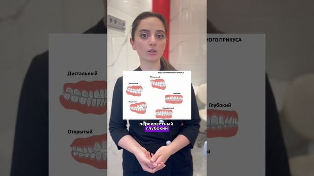Неправильный прикус – это серьезная проблема