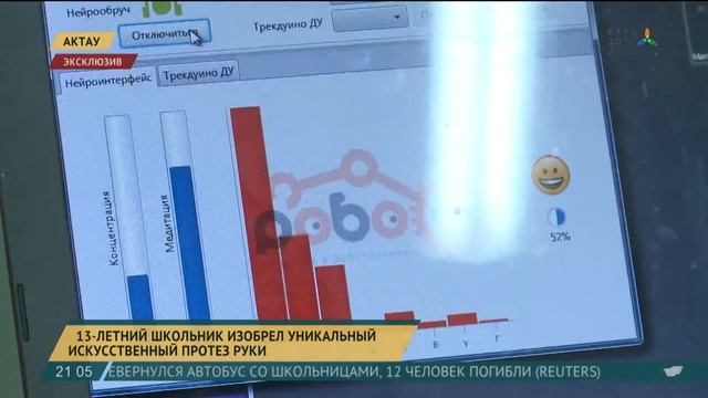 Школьник изобрёл уникальный протез руки на базе Роботрек