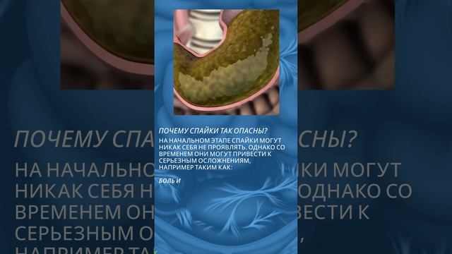 Патогенетическая профилактика спаек брюшины