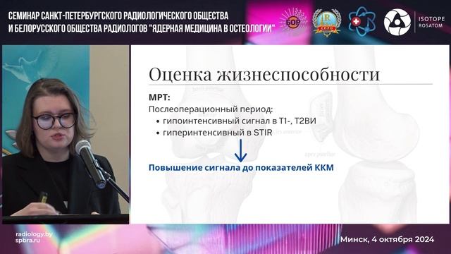 Диагностическая значимость ОФЭКТ-КТ с 99mTc-MDP в диаг-ке жизнеспособности костн. аллотрансплантатов