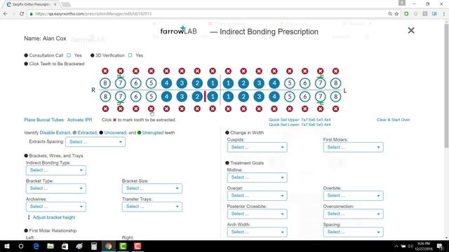 EasyRx EasyVid - Creating an Indirect Bonding Prescription*