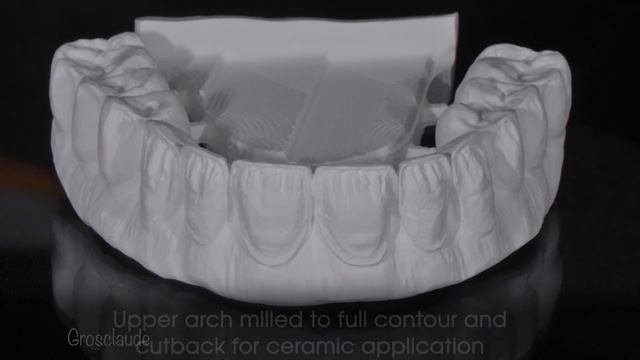 How I made hybrid zirconia upper and lower arches