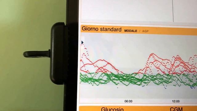 Diasend statistiche e condivisione del freestyle libre e del dexcom g5