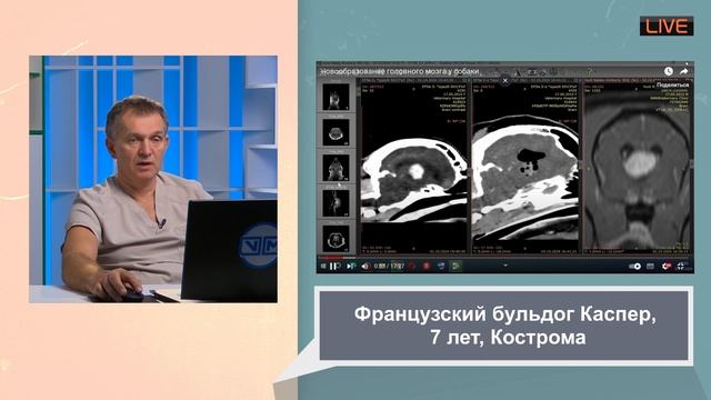 Почему неврологи сами смотрят МРТ и КТ