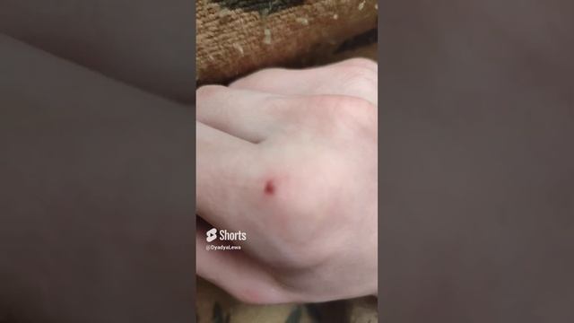 Рукой по тискам