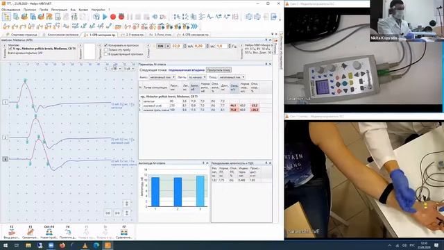 Моторное проведение продолжение  Вебинар ЭМГ для начинающих Часть 7