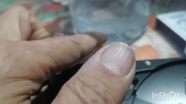 Огромные потери серебра
