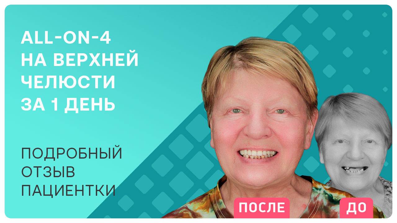 Имплантация зубов при повышенном давлении. Рассказываю, как все прошло!