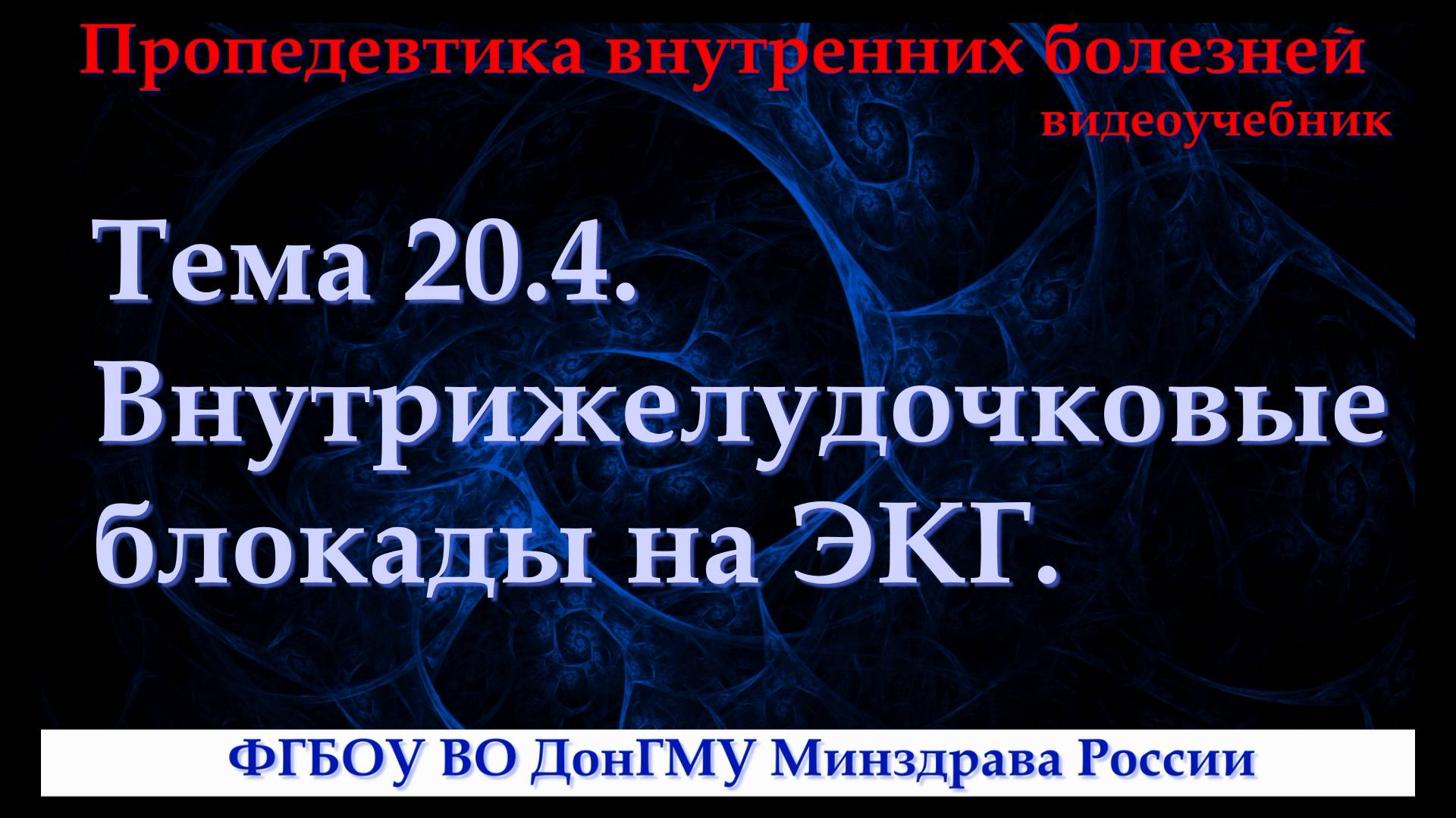 Тема 20.4. Внутрижелудочковые блокады на ЭКГ.