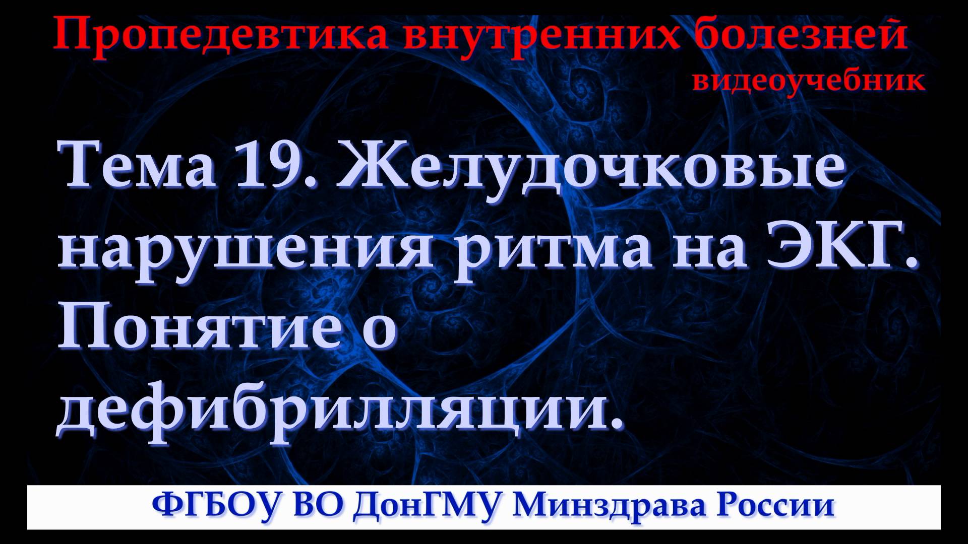 Тема 19. Желудочковые нарушения ритма на ЭКГ. Понятие о дефибрилляции.