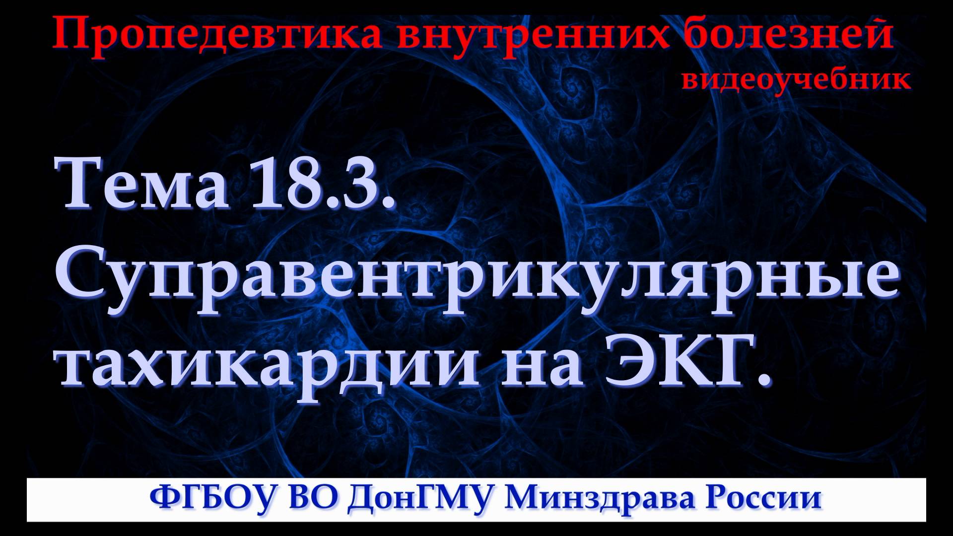 Тема 18.3. Суправентрикулярные тахикардии на ЭКГ.