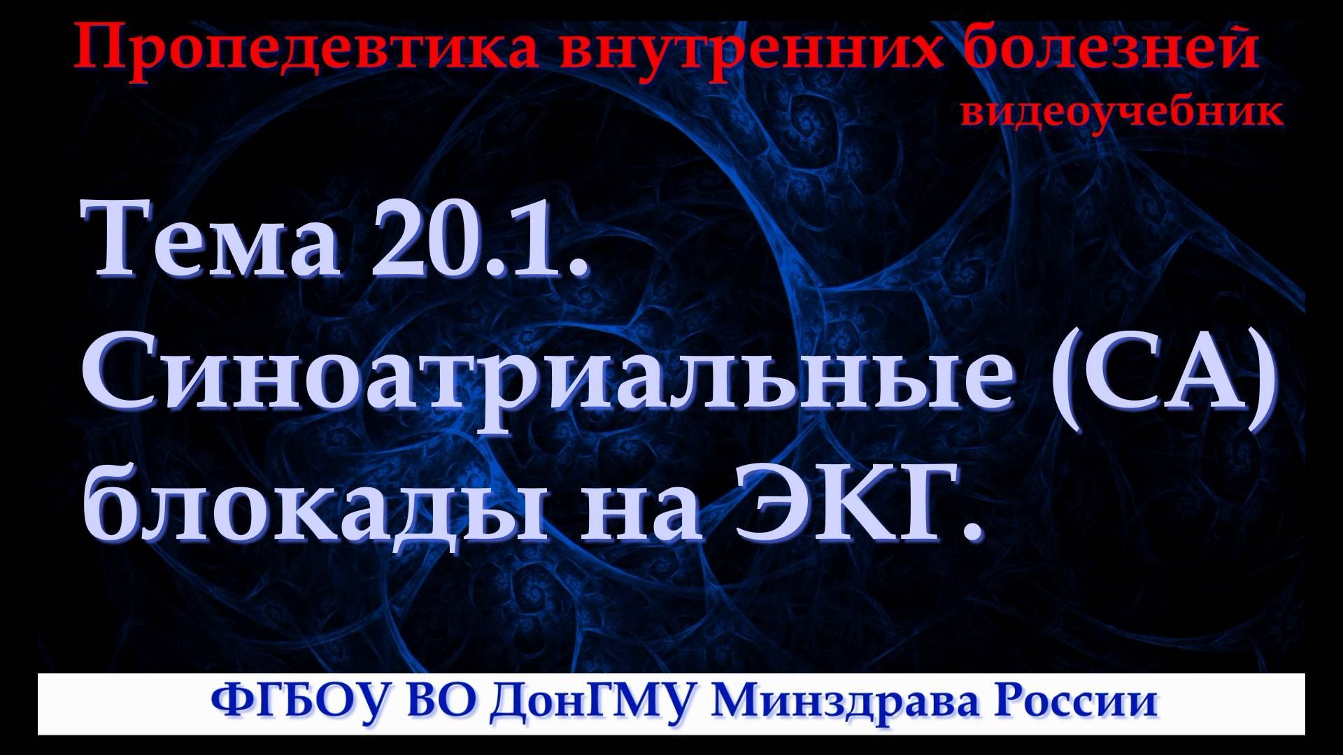 Тема 20.1. Синоатриальные (СА) блокады на ЭКГ.