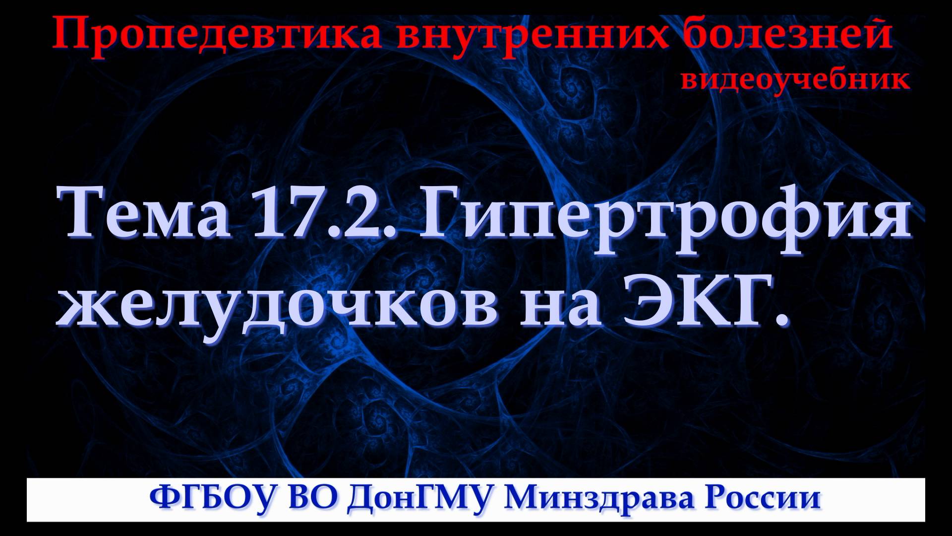 Тема 17.2. Гипертрофия желудочков на ЭКГ.