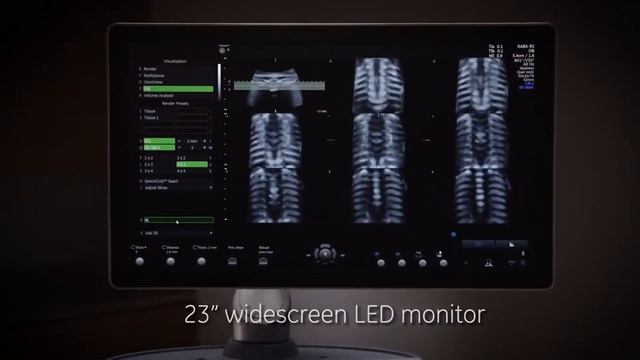 GE Voluson S6 S8