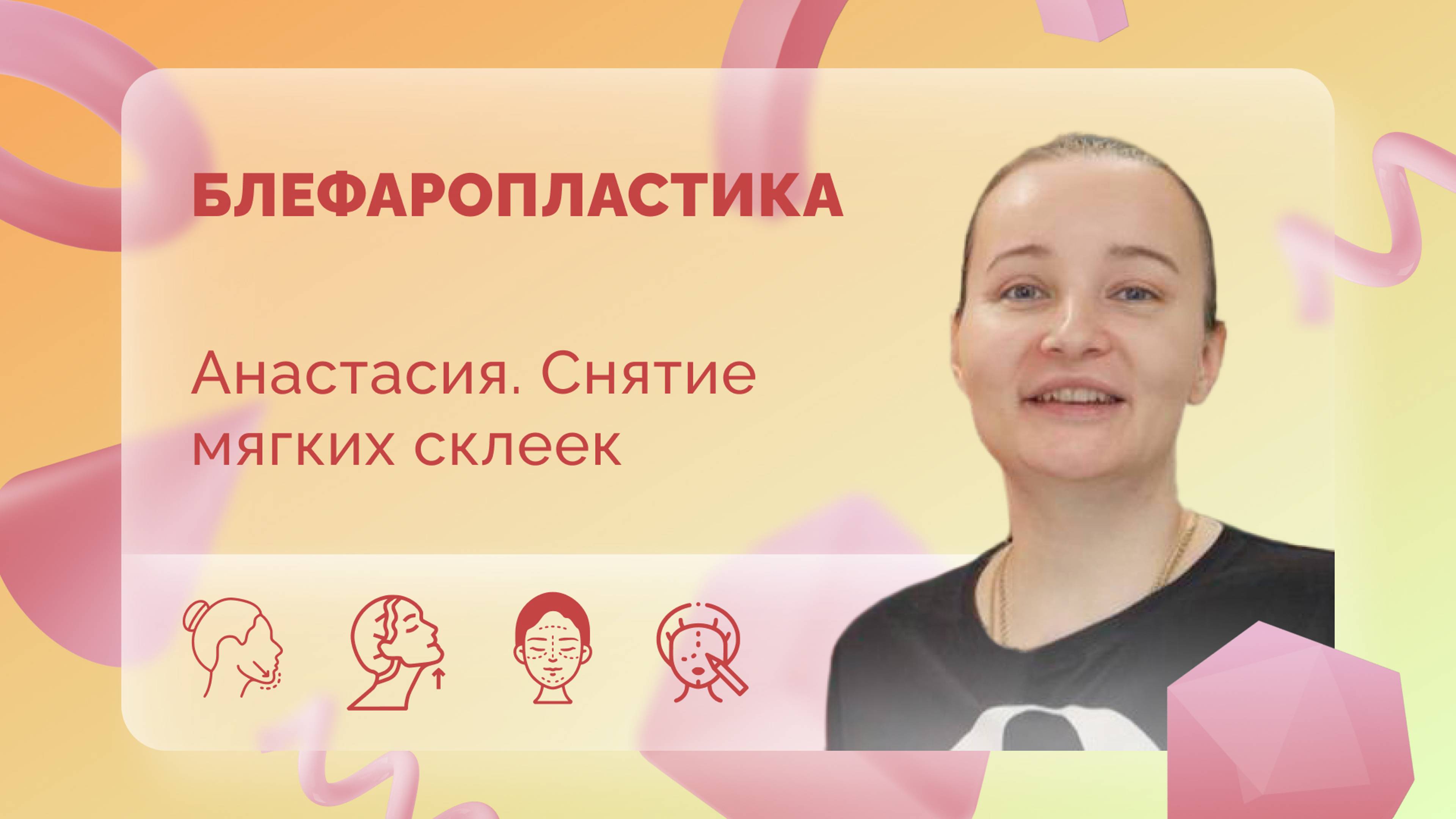 Анастасия. Блефаропластика. Снятие мягких склеечек