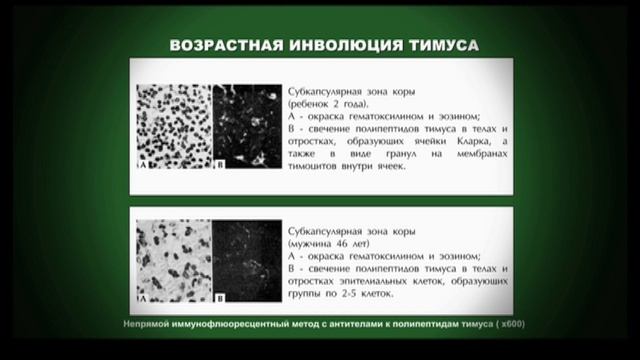 Документальный научно-популярный фильм ВИДОВОЙ ПРЕДЕЛ ЧЕЛОВЕКА