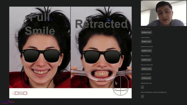 05. Вебинар «Цифровой дизайн улыбки»