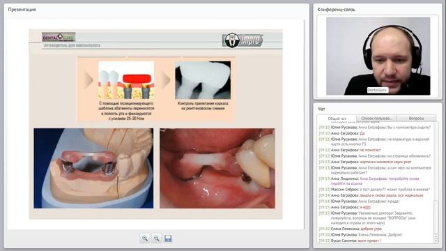02. 2017 01 24  Особенности протезирования на имплантатах с конусным соединением Методики снятия сле